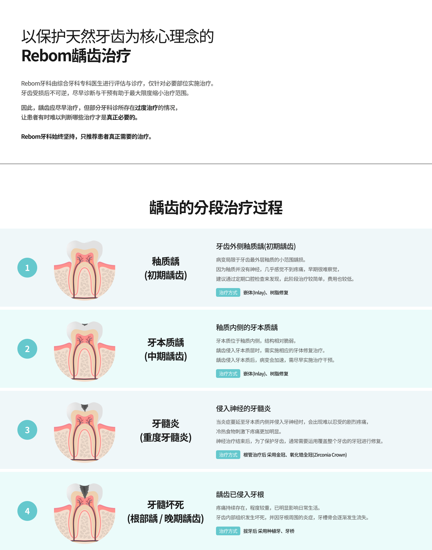 자연치아의 소중함을 아는 리봄치과 충치치료