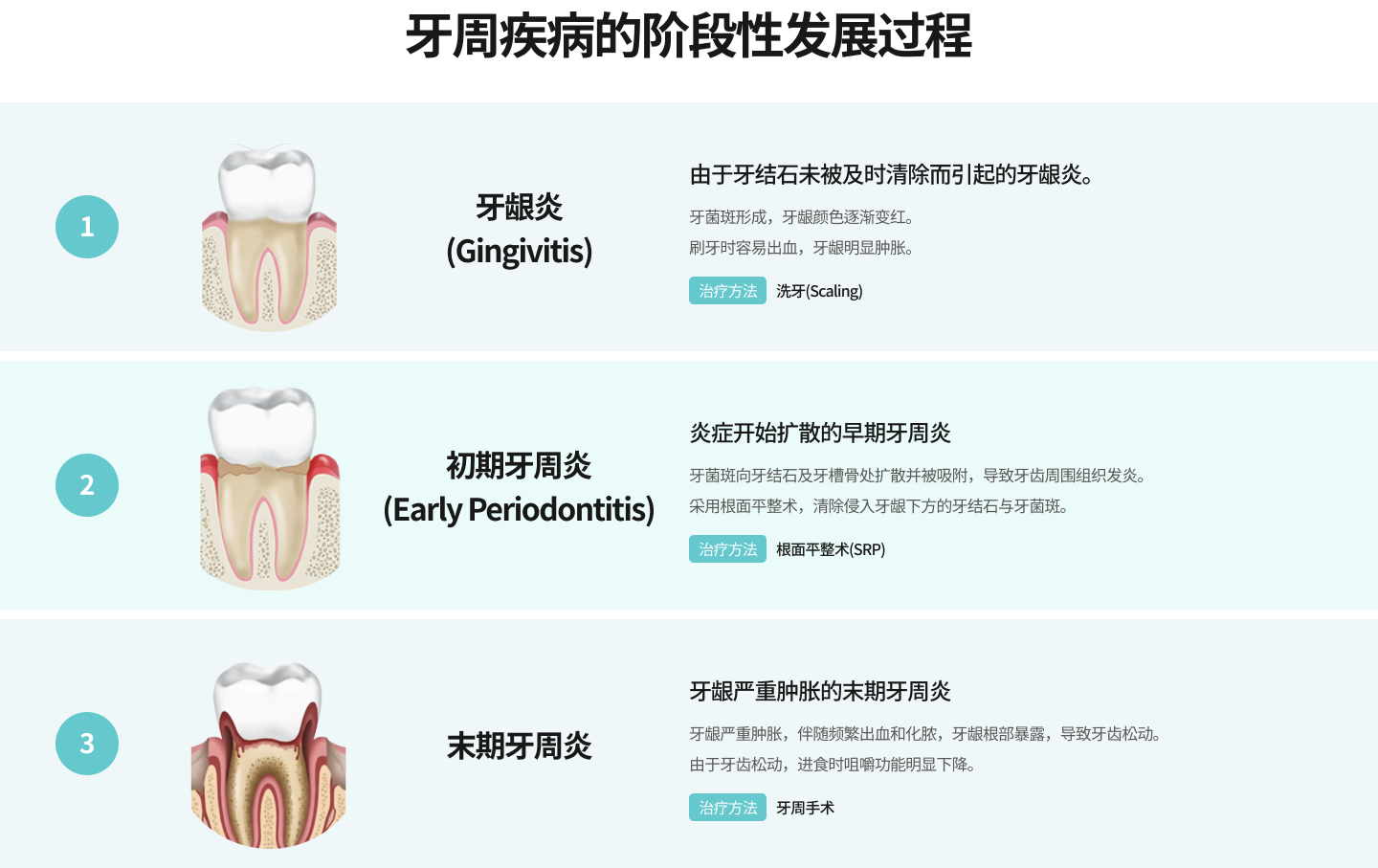 치주질환의 단계별 진행과정