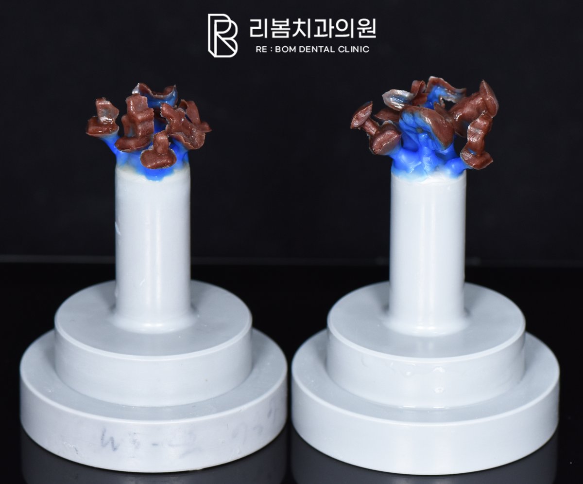 정보 전달을 목적으로 본원 기공실에서 직접 촬영한 사진입니다.