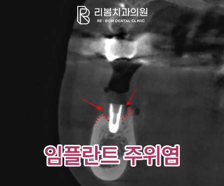 2026.02.03