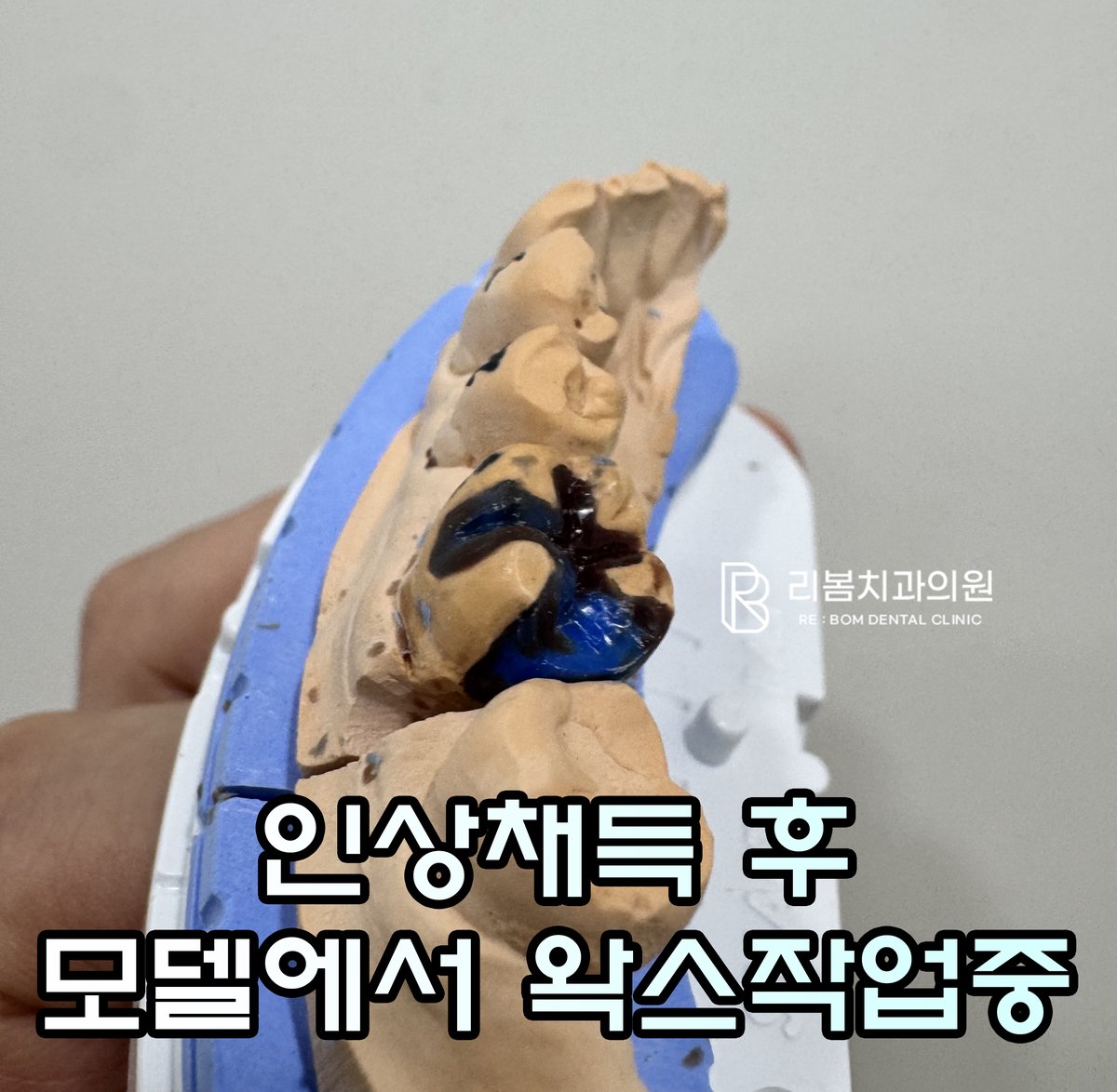 정보 전달을 목적으로 본원 기공실에서 직접 촬영한 사진입니다.