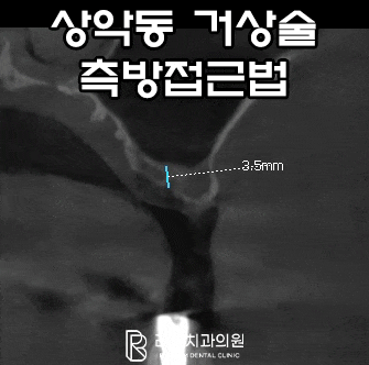 24.05.20 ~ 25.06.17