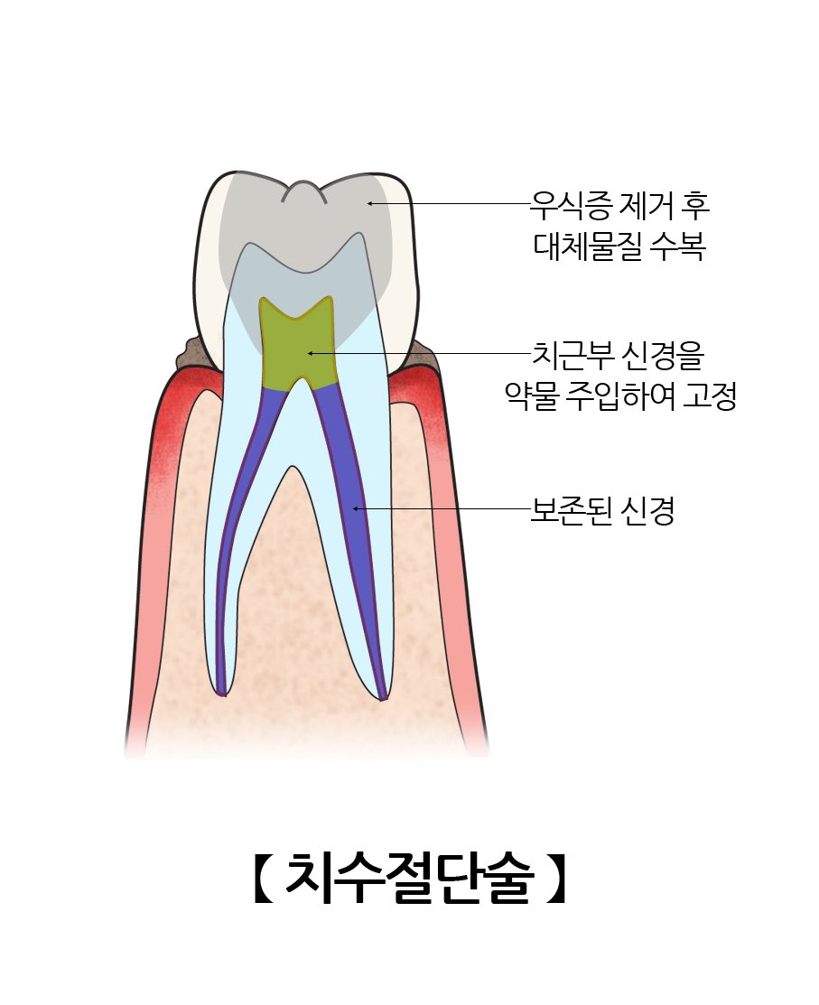 출처 - 구글