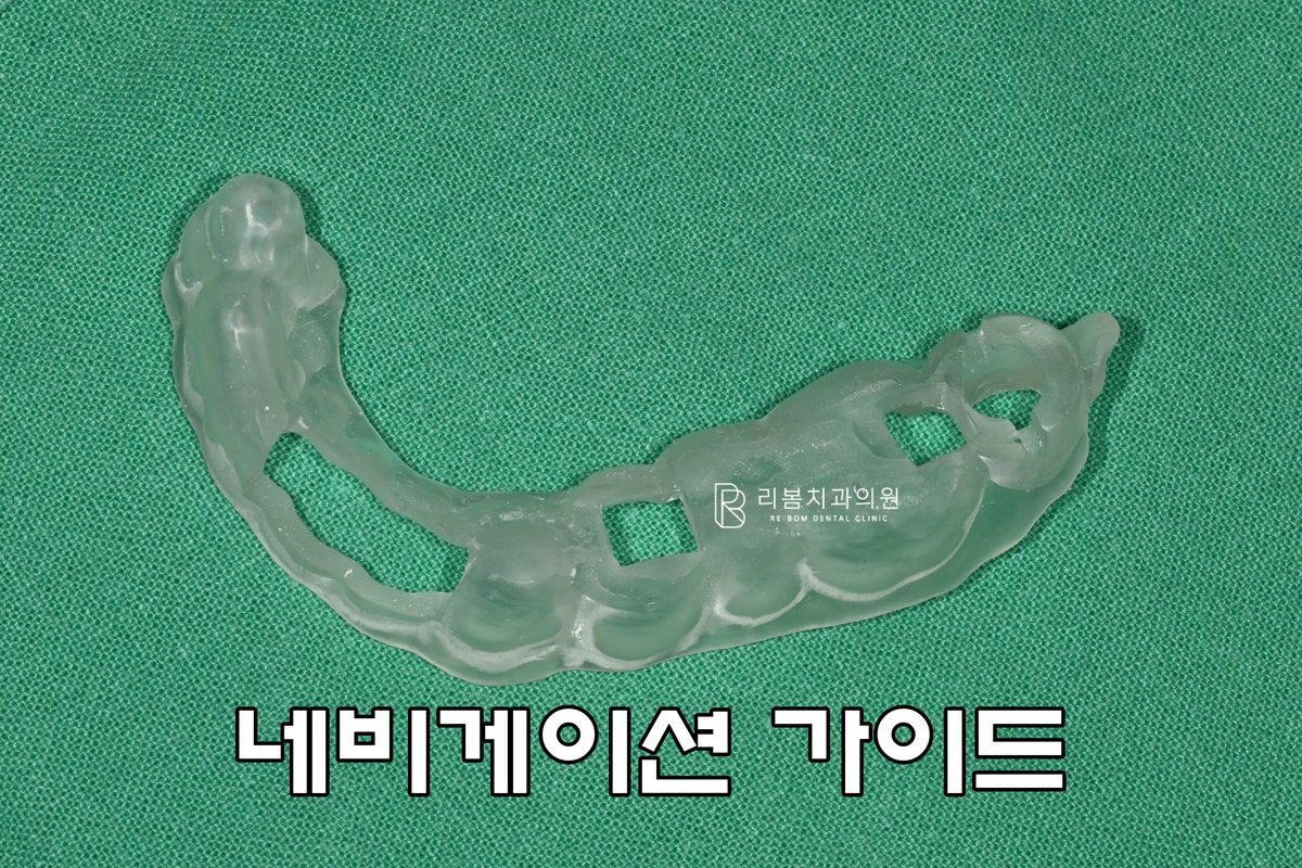 실제로 대표원장이 설계한 가이드