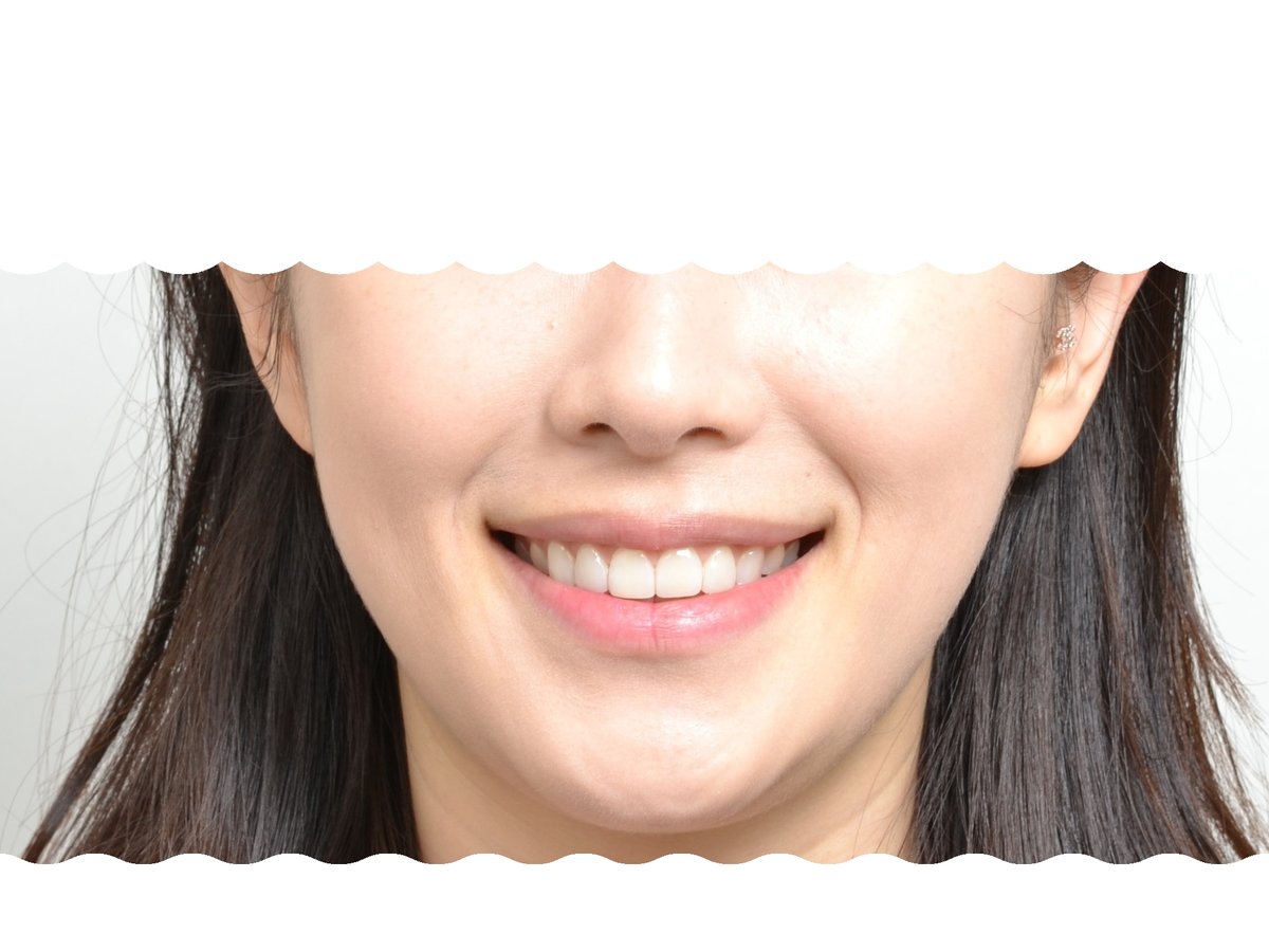 후