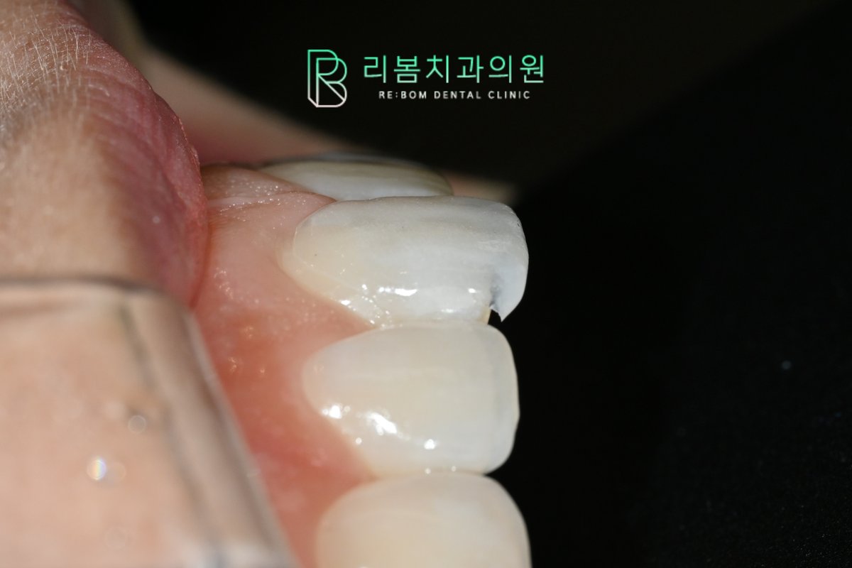 Platinum foil(백금박) 을 이용한 결과물