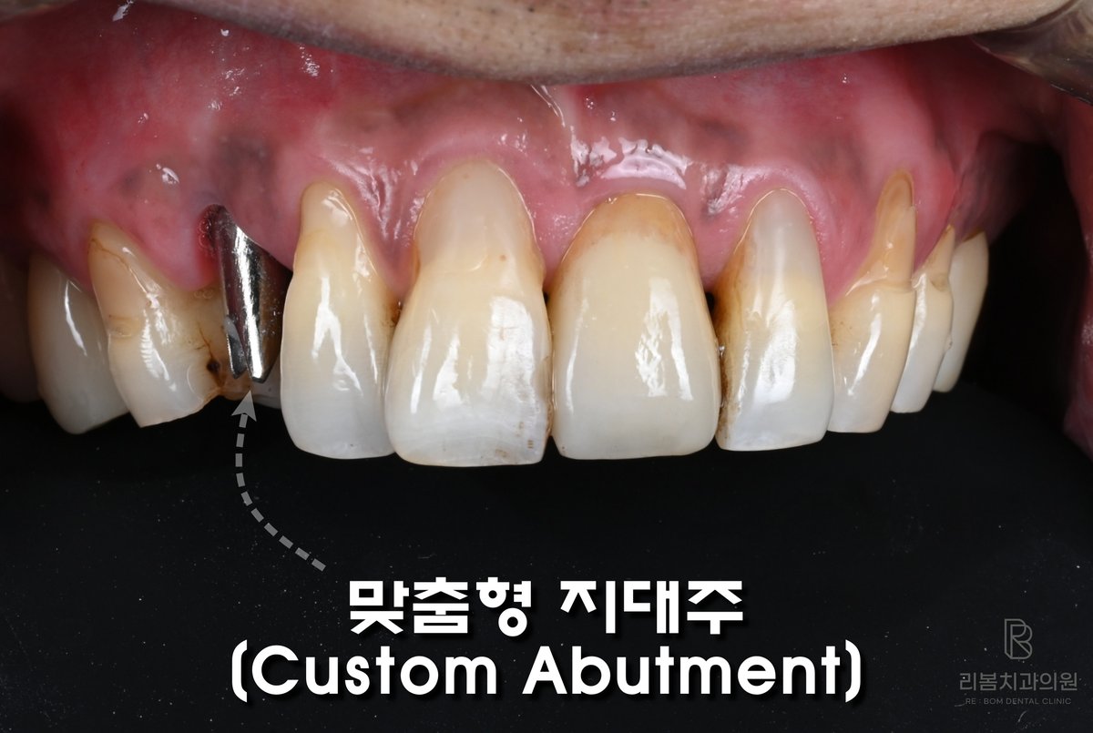 251118 맞춤형지대주
