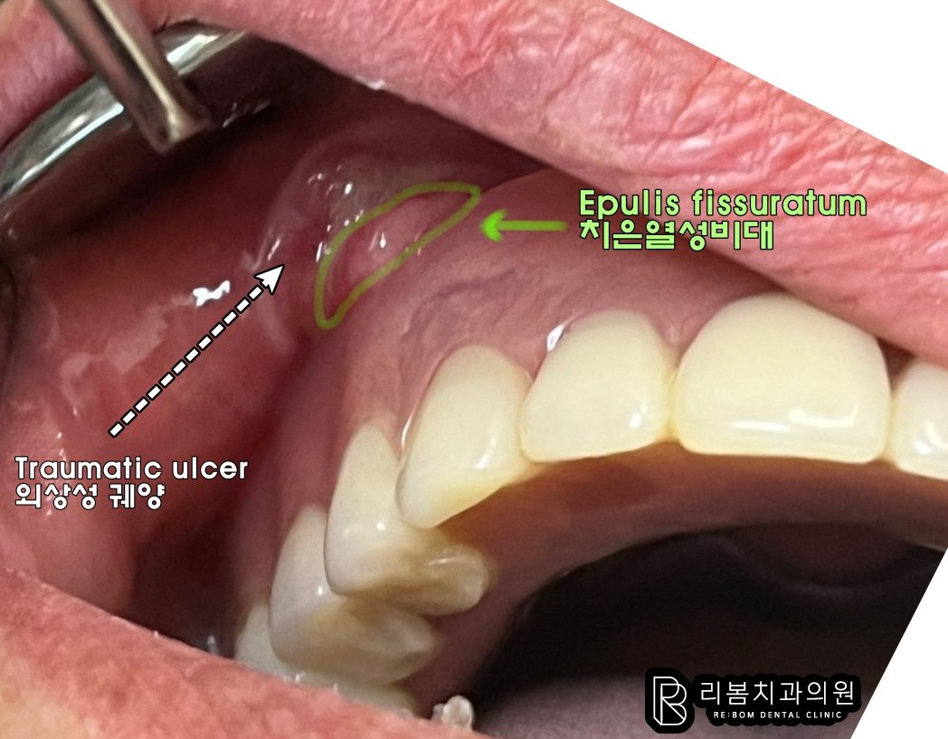 인천 치과 추천