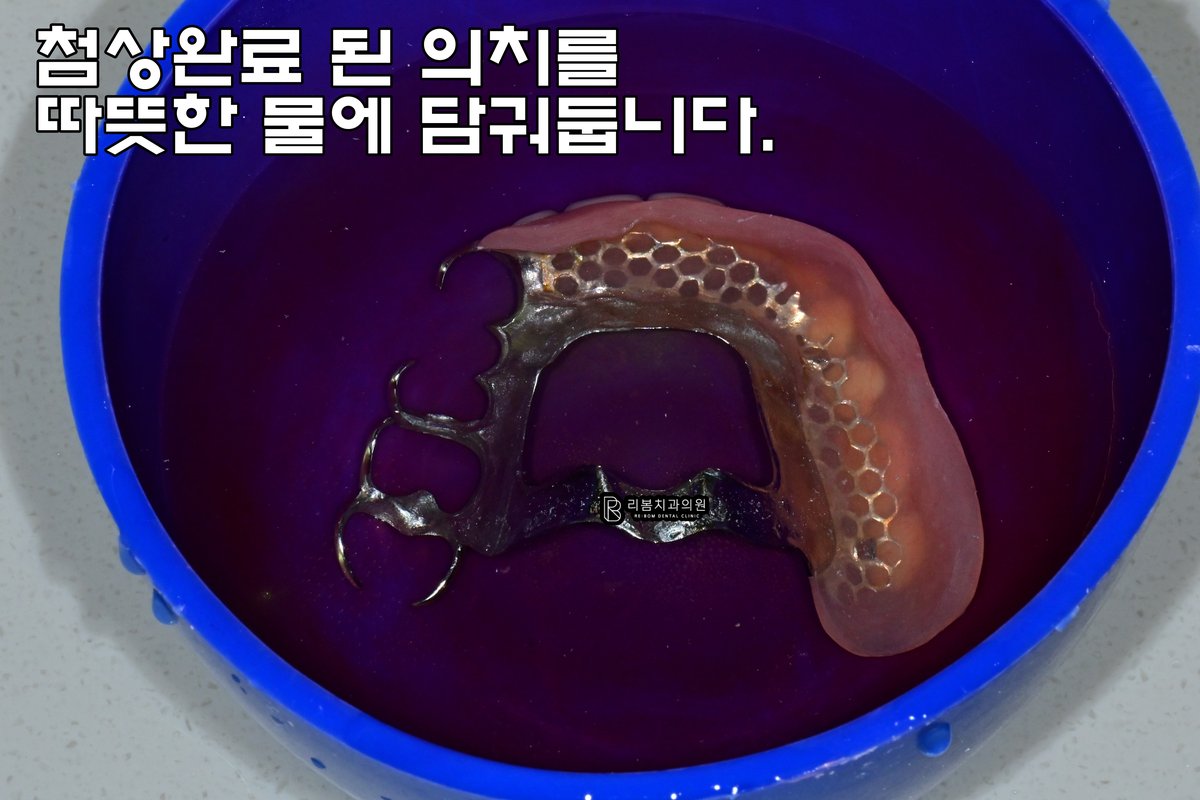 인천 치과 추천
