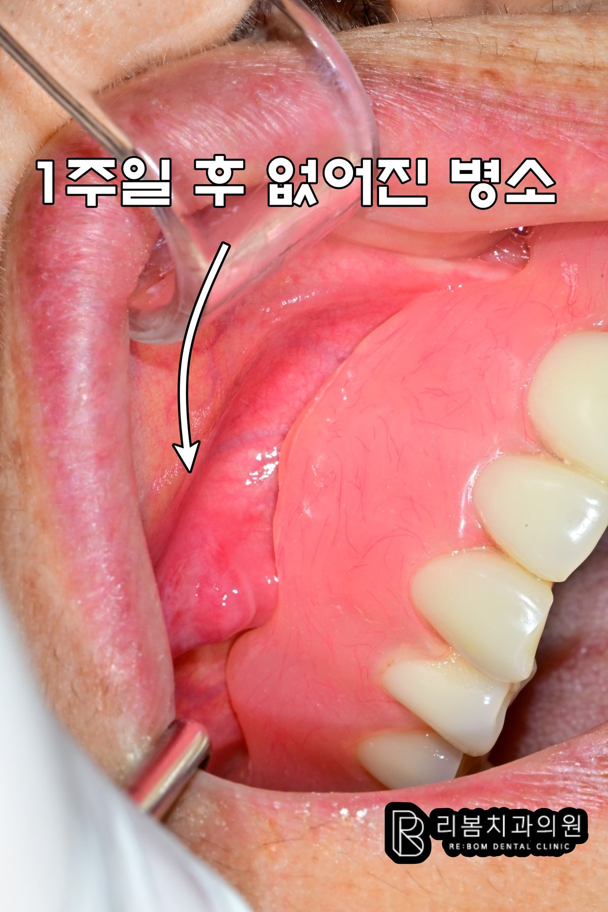인천 치과 추천