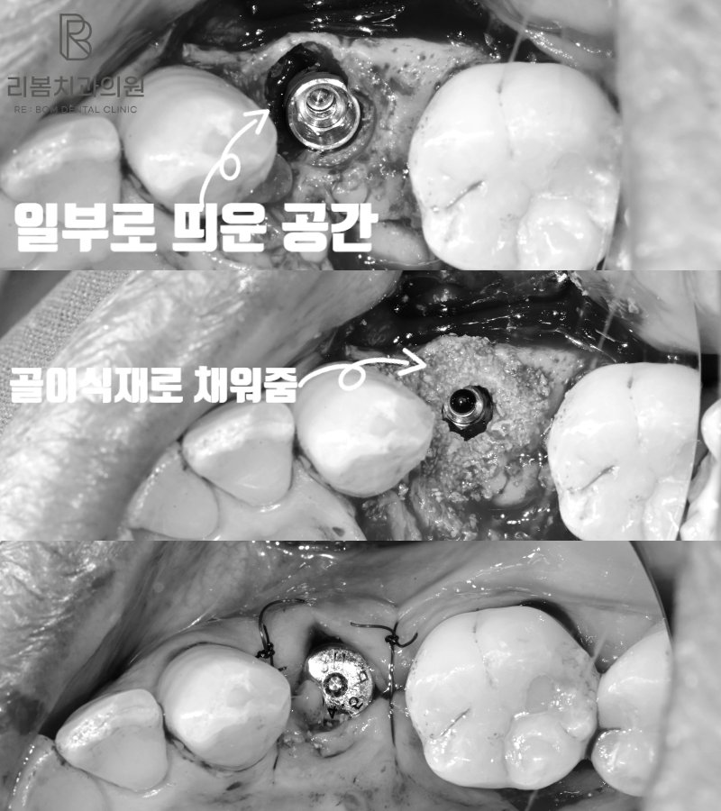 260119. 일부로 공간을 띄워 위치를 조절함.