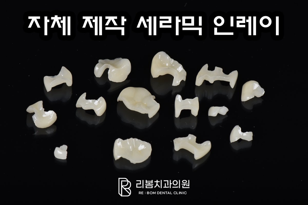 정보 전달을 목적으로 본원 기공실에서 직접 촬영한 사진입니다.